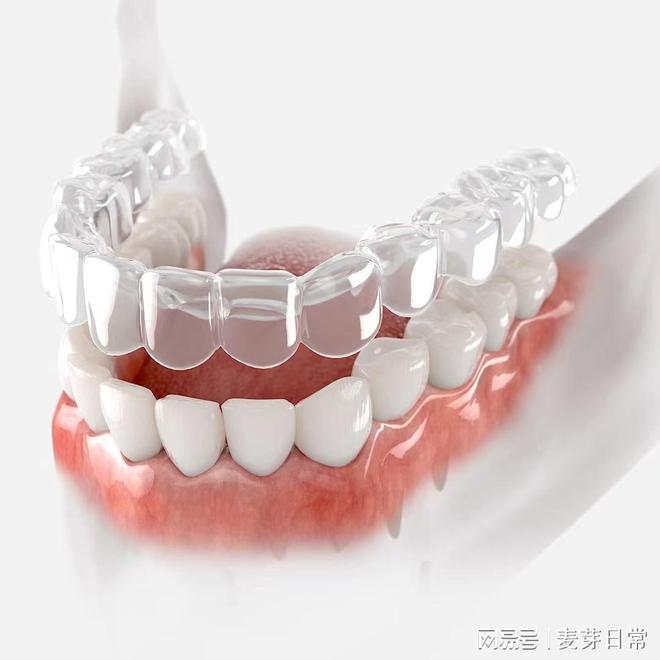 麦芽口腔牙齿矫正的最佳时间究竟在何时？(图1)