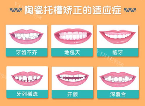 牙齿矫正需要多少费用？分享2024年常见正畸方式收费价目表！(图2)