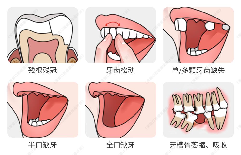 珠澳居民留意了！不限户籍！即日起凭有效证件领取2025年看牙补助(图3)