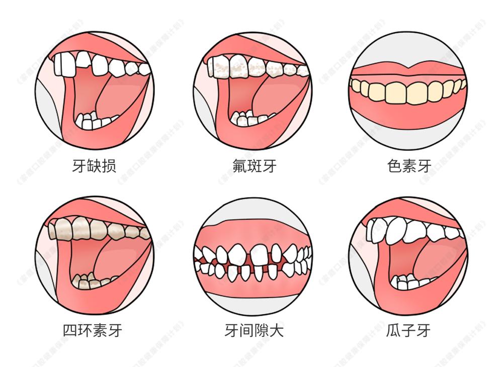 珠澳居民留意了！不限户籍！即日起凭有效证件领取2025年看牙补助(图7)