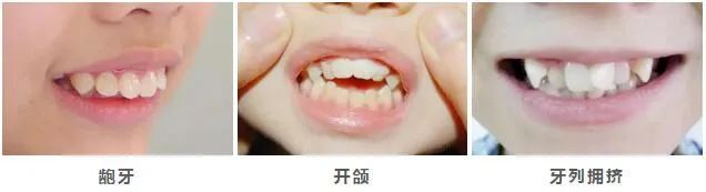 【申领通道】2000元起！领完截止！ 2025“看牙补贴”标准及申领指南！(图4)