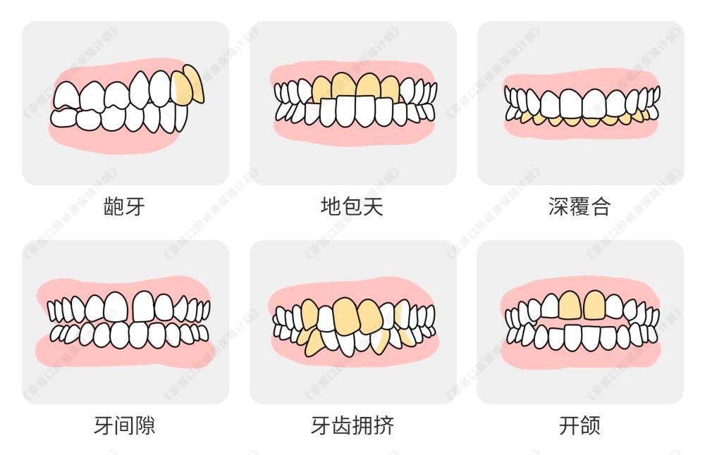 全体在珠市民恭喜了！即日起不限户籍不限地区发放2025年看牙补贴(图5)