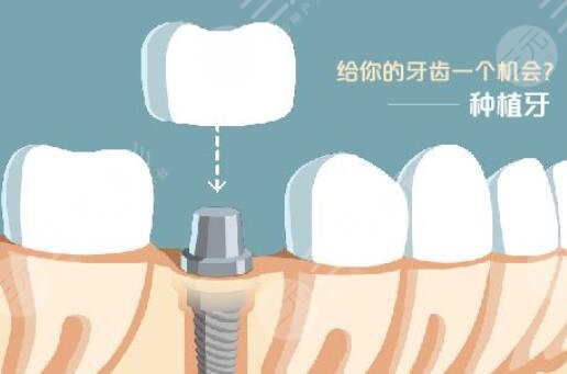 2025年中国正畸行业数量走势、市场结构及重点企业分析(图1)